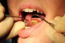 A new dentist centre will be open at the University of Suffolk