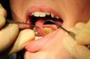 Supervised toothbrushing in schools is among a number of schemes suggested in a £1 million pound push to improve dental services in Suffolk.