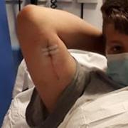 14-year-old Jayden was treated in A&E at Ipswich Hospital recently